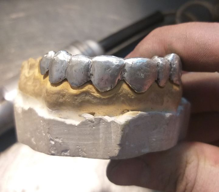 нижние 8 зубов grillz на белом фоне